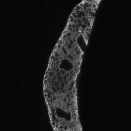 Original tissue image after autofocus.