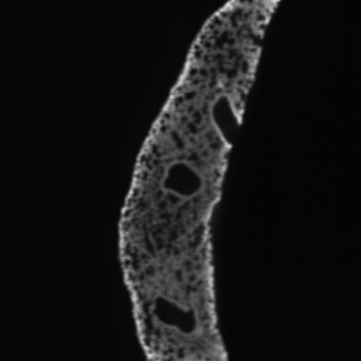 Original tissue image during sample positioning.
